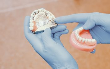 The Advantages of Dental Bridges for Filling the Space of Missing Teeth