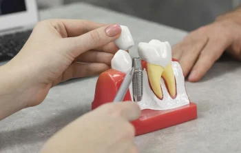 Bone Loss and Dental Implants: What Lindon Patients Should Know