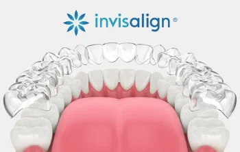 What-Do-Patients-Wish-They-Knew-Before-Starting-Invisalign-in-Lindon,-UT